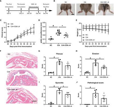 Inhibition of Histone H3 Lysine-27 Demethylase Activity Relieves Rheumatoid Arthritis Symptoms via Repression of IL6 Transcription in Macrophages